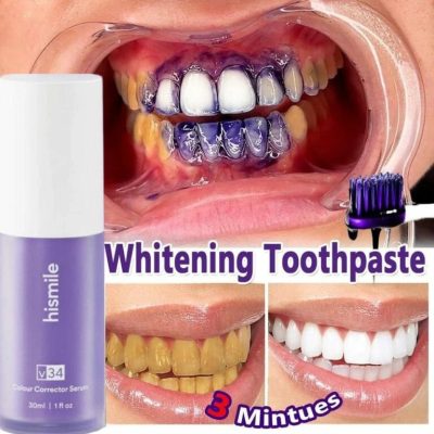 Hismile V34 Color Corrector Serum | High Quality |  Instant Teeth Brightening Solution | 30ml thumbnail 2